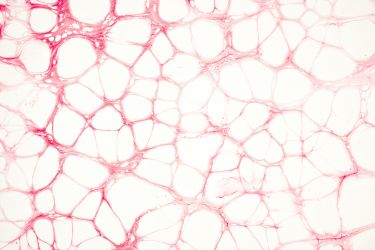 Logo zariadenia Angiologická ambulancia - MEDIVASA, s.r.o. - MUDr. Viliam Bugáň