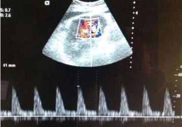 Logo zariadenia SVaLZ, ultrazvukové vyšetrovacie metódy - MUDr. Ingrid Rattajová