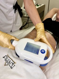 Fotografia 7 od PRESCLI - estetická klinika