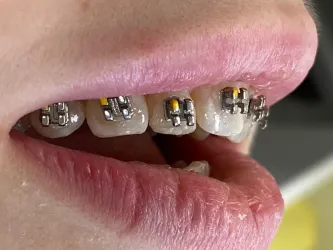 Fotografia miesta 1 od Ambulancia zubného lekárstva - ZUBKA s.r.o. - MUDr. Zuzana Váleková