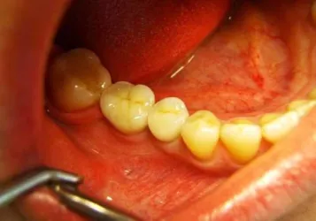 Fotografia miesta 7 od DDDental s.r.o. Súkromné stomatologické pracovisko - MUDr. Jozef Ivančo , CSc.