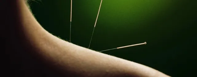 Fotografia miesta 1 od Tradičná Čínska Medicína - Ferdinand Hrabal