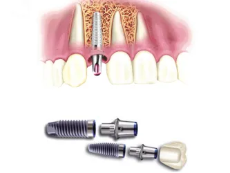Fotografia miesta 2 od Ambulancia zubného lekárstva - Smile Clinic - MUDr. Marek Salka