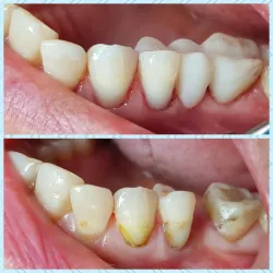 Fotografia miesta 1 od Zubná ambulancia MUDr. Alexa Medzihradského - MDDr. Ľubomír Redaj