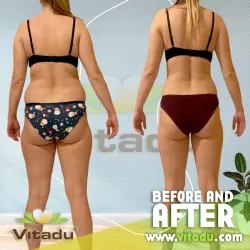 Fotografia miesta 8 od AMBULANCIA VÝŽIVY VITADU - Ing. Oľga Grozdaničová