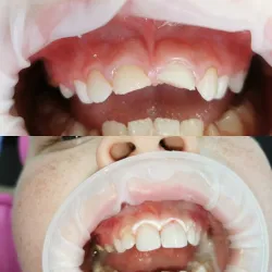 Fotografia miesta 5 od Zubný RTG