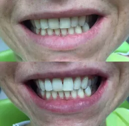 Fotografia miesta 5 od Ambulancia zubného lekárstva - MUDr. Vladimír Bardiovský