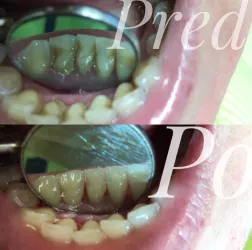 Fotografia miesta 6 od Ambulancia zubného lekárstva - MUDr. Vladimír Bardiovský