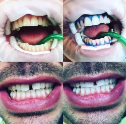 Fotografia miesta 9 od Ambulancia zubného lekárstva - MUDr. Vladimír Bardiovský