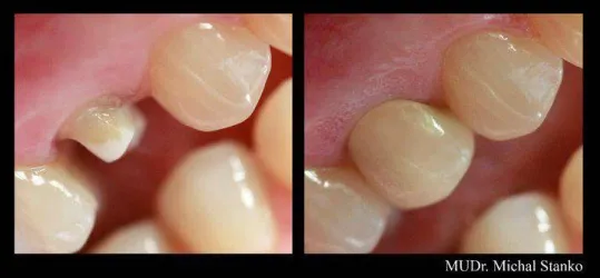 Fotografia miesta 8 od Rádiologická ambulancia - MUDr. Michal Stanko, LUXDENT s.r.o., zariadenie spoločných vyšetrovacích a liečebných zložiek