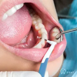 Fotografia miesta 8 od Zubná ambulancia Brill Dent