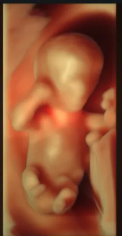Fotografia miesta 9 od Gynekologická ambulancia, 4D ultrazvuk, 3D ultrazvuk - MUDr. Štefan Vojtaššák