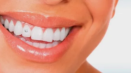 Fotografia miesta 1 od Ambulancia zubného lekárstva - MUDr. Ján Littva