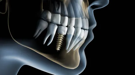 Fotografia miesta 3 od Pohotovosť stomatologická / zubná (LSPP)