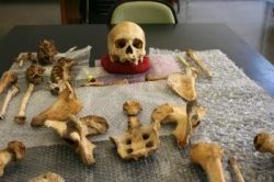 Kosti – ona či on, určovanie pohlavia vo forenznej medicíne?