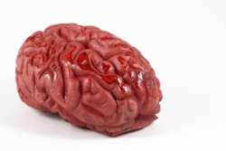 Čo je cievna mozgová príhoda?