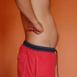 Na Slovensku trpí nadhmotnosťou a obezitou viac ako polovica dospelých