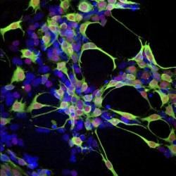 Kmeňové bunky možno vrátia zrak slepým