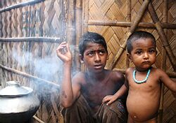 UNICEF: Rozvojové štáty musia urobiť viac proti chronickej podvýžive detí