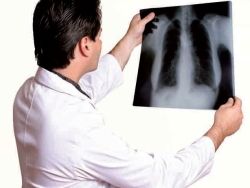 Chronická obštrukčná choroba pľúc