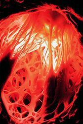 Jurkovičová: Kardiovaskulárne choroby sú najčastešjou príčinou smrti v SR