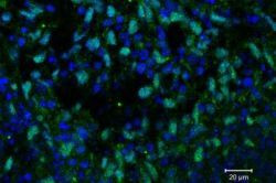 Sietnica z embryonálnych kmeňových buniek