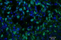 Sietnica z embryonálnych kmeňových buniek