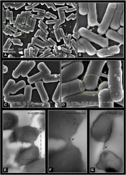 Baktérie komunikujú nanotrubicami
