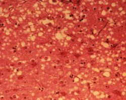 Príčina "choroby šialených kráv" sa vyvíja