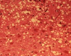 Príčina "choroby šialených kráv" sa vyvíja