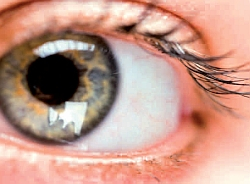 Slzenie očí – príčiny a možnosti liečby