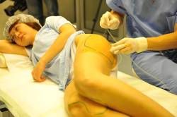 Zväčšovanie veľkosti prsníkov kmeňovými bunkami už aj na Slovensku