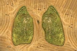 Nedovoľte rakovine vziať Vám dych. Predýchajte strach... Informujte sa!