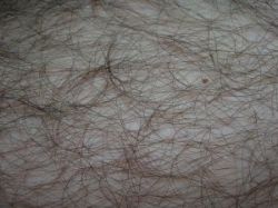 Nežiaduce ochlpenie