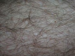 Nežiaduce ochlpenie