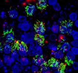 Prvý kľúč k likvidácii hrozby vírusov ebola a marburg