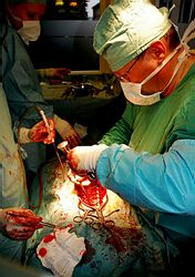 Nový operačný systém skoliózy mal premiéru v Žilinskej nemocnici