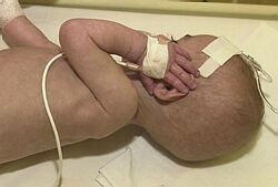 Polícia preveruje prípad zanedbaného rómskeho dieťaťa