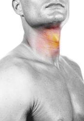 Akútna laryngitída