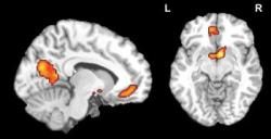 Budúce hity možno vyčítať z mozgov tínedžerov