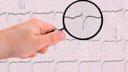 Intervenčná kardiológia a kardiovaskulárna intervenčná rádiológia