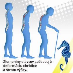 Bojujte proti osteoporóze každý deň!