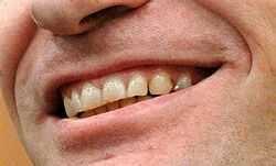 Povinnosť neustále sa usmievať vedie k depresiám