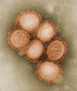 Prasacia chrípka je ľudským vírusom, neprenášajú ju prasatá