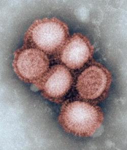 Skombinovaný chrípkový vírus môže vyvolať pandémiu