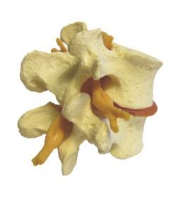 Ako a prečo vzniká osteoporóza?