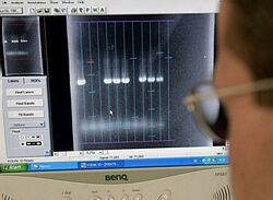 Vedci z 11 univerzít tvoria databázu DNA pre výskum autizmu