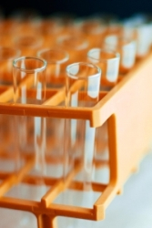 Alkaptonúria – ochronóza