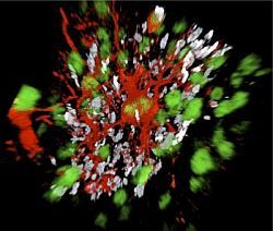 Nervové kmeňové bunky vyliečili miechu