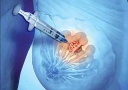 Krásne poprsie - časovaná bomba